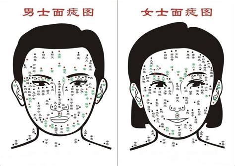 有臉頰有痣|「臉痣」看健康、運勢！專家解析10種痣：眼下這顆痣。